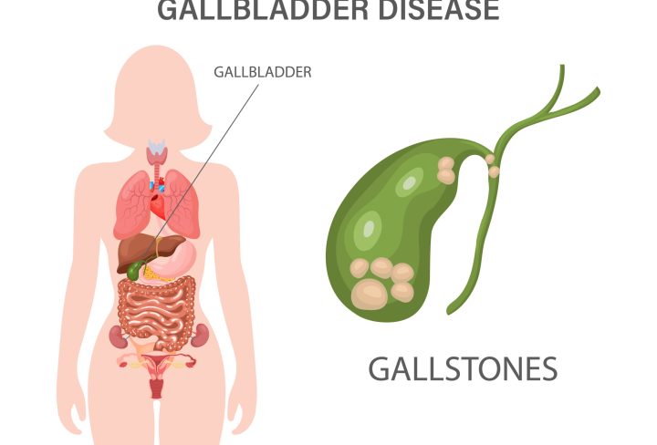 288796009_683009ab-09b6-49a4-996e-9b3f5f0755f4 (1)