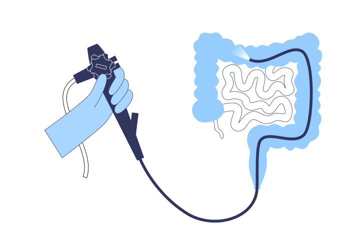 Colonoscopy is a minimally invasive procedure. Examination and treatment of the large intestine. Disorder of the colon, polyps, inflammation or swelling of bowel. Gastrointestinal disorder flat vector